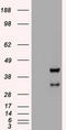 Hematopoietically-expressed homeobox protein HHEX antibody, CF500219, Origene, Western Blot image 