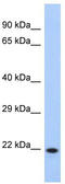 Coiled-Coil Domain Containing 27 antibody, TA338864, Origene, Western Blot image 