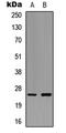 Ephrin A5 antibody, LS-C356004, Lifespan Biosciences, Western Blot image 