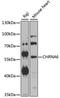 Neuronal acetylcholine receptor subunit alpha-6 antibody, GTX66522, GeneTex, Western Blot image 