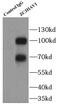 Zinc Finger CCCH-Type Containing, Antiviral 1 antibody, FNab09606, FineTest, Immunoprecipitation image 