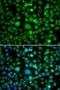TEK Receptor Tyrosine Kinase antibody, LS-B14782, Lifespan Biosciences, Immunofluorescence image 