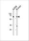 Leucine zipper putative tumor suppressor 1 antibody, A06359, Boster Biological Technology, Western Blot image 