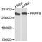 Pre-mRNA-processing-splicing factor 8 antibody, STJ27847, St John