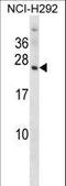Olfactory Marker Protein antibody, LS-C163121, Lifespan Biosciences, Western Blot image 
