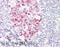 Atypical Chemokine Receptor 3 antibody, 43-702, ProSci, Enzyme Linked Immunosorbent Assay image 