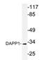 Dual adapter for phosphotyrosine and 3-phosphotyrosine and 3-phosphoinositide antibody, AP20333PU-N, Origene, Western Blot image 