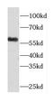 Coronin 6 antibody, FNab01885, FineTest, Western Blot image 