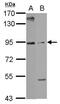 Armadillo Repeat Containing 3 antibody, PA5-32084, Invitrogen Antibodies, Western Blot image 