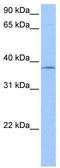 Sprouty RTK Signaling Antagonist 2 antibody, TA339692, Origene, Western Blot image 