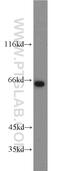 72 kDa inositol polyphosphate 5-phosphatase antibody, 17797-1-AP, Proteintech Group, Western Blot image 