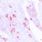 Abhydrolase Domain Containing 12B antibody, GTX54935, GeneTex, Immunohistochemistry paraffin image 