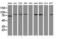 Catenin Beta 1 antibody, LS-C172580, Lifespan Biosciences, Western Blot image 