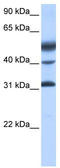 Cyclic AMP-dependent transcription factor ATF-1 antibody, TA343512, Origene, Western Blot image 