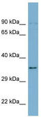 UBX Domain Protein 1 antibody, TA345105, Origene, Western Blot image 