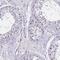 Ribosome biogenesis protein BOP1 antibody, PA5-61611, Invitrogen Antibodies, Immunohistochemistry frozen image 