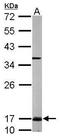 Ubiquitin Conjugating Enzyme E2 N antibody, GTX113290, GeneTex, Western Blot image 