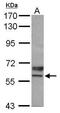 Ubiquitin carboxyl-terminal hydrolase 3 antibody, PA5-30341, Invitrogen Antibodies, Western Blot image 