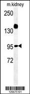 Armadillo repeat-containing protein 5 antibody, 61-913, ProSci, Western Blot image 