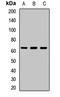 G Protein-Coupled Receptor Kinase 1 antibody, orb412146, Biorbyt, Western Blot image 