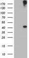 1-Acylglycerol-3-Phosphate O-Acyltransferase 5 antibody, NBP2-01664, Novus Biologicals, Western Blot image 