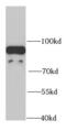 NADH:Ubiquinone Oxidoreductase Core Subunit S1 antibody, FNab05629, FineTest, Western Blot image 