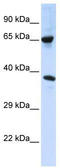 Alpha Tubulin Acetyltransferase 1 antibody, TA329480, Origene, Western Blot image 