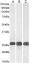 Synaptosome Associated Protein 25 antibody, PA1-9102, Invitrogen Antibodies, Western Blot image 