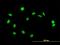 Zinc Finger BED-Type Containing 1 antibody, H00009189-B01P, Novus Biologicals, Immunocytochemistry image 