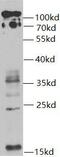 Ubiquitin B antibody, FNab09865, FineTest, Western Blot image 