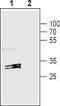 Gap Junction Protein Beta 1 antibody, TA328774, Origene, Western Blot image 