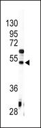 Angiotensinogen antibody, LS-C97170, Lifespan Biosciences, Western Blot image 
