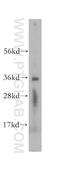 Short Chain Dehydrogenase/Reductase Family 39U Member 1 antibody, 16585-1-AP, Proteintech Group, Western Blot image 