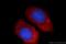 Ubiquitin-conjugating enzyme E2 C antibody, 66087-1-Ig, Proteintech Group, Immunofluorescence image 