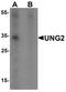 UNG1 antibody, PA5-34551, Invitrogen Antibodies, Western Blot image 