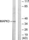 MAPK Activated Protein Kinase 3 antibody, TA314705, Origene, Western Blot image 