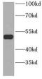 GDP Dissociation Inhibitor 2 antibody, FNab03406, FineTest, Western Blot image 