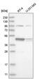 Sister chromatid cohesion protein DCC1 antibody, PA5-64995, Invitrogen Antibodies, Western Blot image 