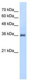 Phospholipid Phosphatase 1 antibody, TA329515, Origene, Western Blot image 