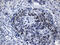 LIM Homeobox 2 antibody, M05940-2, Boster Biological Technology, Immunohistochemistry paraffin image 