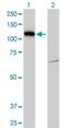 LLGL Scribble Cell Polarity Complex Component 2 antibody, H00003993-M06, Novus Biologicals, Western Blot image 