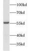 Forkhead box protein C2 antibody, FNab03191, FineTest, Western Blot image 