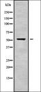 Carboxypeptidase A6 antibody, orb338133, Biorbyt, Western Blot image 