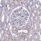 Coronin 2A antibody, HPA041161, Atlas Antibodies, Immunohistochemistry paraffin image 