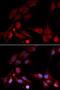 Amyloid beta A4 precursor protein-binding family B member 1 antibody, LS-C335192, Lifespan Biosciences, Immunofluorescence image 