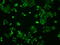 Signal Transducer And Activator Of Transcription 1 antibody, GTX83552, GeneTex, Immunofluorescence image 