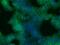 Catenin Beta 1 antibody, LS-B4509, Lifespan Biosciences, Immunocytochemistry image 