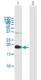 Zinc Finger CCHC-Type Containing 13 antibody, H00389874-B01P, Novus Biologicals, Western Blot image 