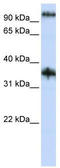 Ferric Chelate Reductase 1 Like antibody, TA341930, Origene, Western Blot image 
