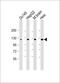 Disabled homolog 2-interacting protein antibody, M02480, Boster Biological Technology, Western Blot image 